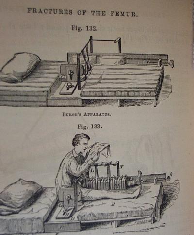 civil war medicine for the union army